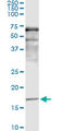 Synuclein Alpha antibody, LS-C198233, Lifespan Biosciences, Immunoprecipitation image 