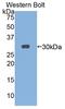 Interleukin 2 Receptor Subunit Gamma antibody, LS-C374148, Lifespan Biosciences, Western Blot image 