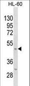 Potassium Voltage-Gated Channel Subfamily J Member 11 antibody, LS-C158223, Lifespan Biosciences, Western Blot image 