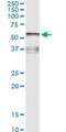 Alpha 2-HS Glycoprotein antibody, H00000197-M02, Novus Biologicals, Immunoprecipitation image 