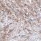 B-Raf Proto-Oncogene, Serine/Threonine Kinase antibody, NBP2-59034, Novus Biologicals, Immunohistochemistry paraffin image 