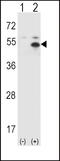 Signal Transducing Adaptor Molecule antibody, 61-134, ProSci, Western Blot image 