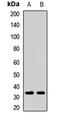 Quiescin Sulfhydryl Oxidase 1 antibody, LS-C668055, Lifespan Biosciences, Western Blot image 