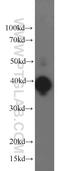 Mitogen-Activated Protein Kinase 1 antibody, 51068-1-AP, Proteintech Group, Western Blot image 