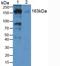 Alpha-2-macroglobulin antibody, LS-C292746, Lifespan Biosciences, Western Blot image 