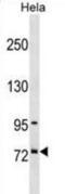 SURP and G-patch domain-containing protein 1 antibody, abx029104, Abbexa, Western Blot image 