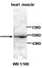 Mucin 16, Cell Surface Associated antibody, orb77318, Biorbyt, Western Blot image 
