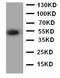 Angiopoietin Like 3 antibody, LS-C313196, Lifespan Biosciences, Western Blot image 