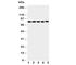 X-Ray Repair Cross Complementing 5 antibody, R30724, NSJ Bioreagents, Western Blot image 