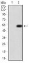 Enhancer Of Zeste 2 Polycomb Repressive Complex 2 Subunit antibody, NBP2-52463, Novus Biologicals, Western Blot image 