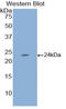 Endothelial Cell Specific Molecule 1 antibody, LS-C293747, Lifespan Biosciences, Western Blot image 