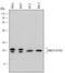 NME/NM23 Nucleoside Diphosphate Kinase 1 antibody, AF6019, R&D Systems, Western Blot image 