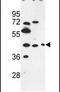 Pregnancy Specific Beta-1-Glycoprotein 3 antibody, PA5-26564, Invitrogen Antibodies, Western Blot image 