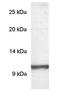 Phosphodiesterase 6G antibody, GTX25664, GeneTex, Western Blot image 