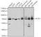 Acyl-CoA Synthetase Short Chain Family Member 2 antibody, STJ28555, St John