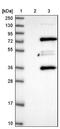 Membrane Palmitoylated Protein 7 antibody, NBP1-81989, Novus Biologicals, Western Blot image 