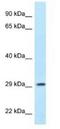 Protein Phosphatase 1 Regulatory Subunit 3B antibody, NBP1-79917, Novus Biologicals, Western Blot image 