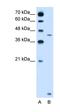 Solute Carrier Family 46 Member 3 antibody, orb325132, Biorbyt, Western Blot image 