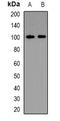 Phosphatidylinositol 3-Kinase Catalytic Subunit Type 3 antibody, orb382585, Biorbyt, Western Blot image 