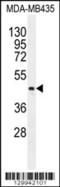 Lipase Family Member K antibody, 56-114, ProSci, Western Blot image 