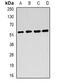 Fumarate Hydratase antibody, abx141783, Abbexa, Western Blot image 