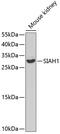Siah E3 Ubiquitin Protein Ligase 1 antibody, GTX55799, GeneTex, Western Blot image 