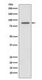 Hyaluronan mediated motility receptor antibody, M05056, Boster Biological Technology, Western Blot image 