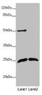 Rho GDP Dissociation Inhibitor Gamma antibody, LS-C677188, Lifespan Biosciences, Western Blot image 