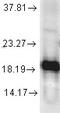 Superoxide Dismutase 1 antibody, TA326595, Origene, Western Blot image 