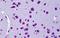 CYLD Lysine 63 Deubiquitinase antibody, GTX89126, GeneTex, Immunohistochemistry paraffin image 