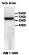 BCL2L2-PABPN1 Readthrough antibody, orb77632, Biorbyt, Western Blot image 