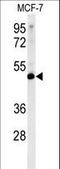 Lymphocyte Specific Protein 1 antibody, LS-C163909, Lifespan Biosciences, Western Blot image 