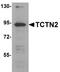 Tectonic-2 antibody, A11196, Boster Biological Technology, Western Blot image 