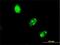 E3 ubiquitin-protein ligase UBR4 antibody, H00023352-M01, Novus Biologicals, Immunocytochemistry image 