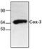 Prostaglandin-Endoperoxide Synthase 1 antibody, GTX59716, GeneTex, Western Blot image 