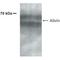 Adhesion Molecule With Ig Like Domain 2 antibody, NB300-247, Novus Biologicals, Western Blot image 