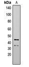 Autophagy Related 4B Cysteine Peptidase antibody, LS-C354558, Lifespan Biosciences, Western Blot image 