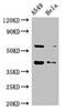 Survival Of Motor Neuron 2, Centromeric antibody, CSB-PA614982LA01HU, Cusabio, Western Blot image 