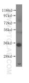Ribosomal Protein Lateral Stalk Subunit P0 antibody, 11290-2-AP, Proteintech Group, Western Blot image 