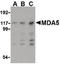 Interferon Induced With Helicase C Domain 1 antibody, LS-B2349, Lifespan Biosciences, Western Blot image 
