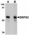 Sushi Repeat Containing Protein X-Linked 2 antibody, orb94339, Biorbyt, Western Blot image 