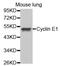 Cyclin E1 antibody, MBS125544, MyBioSource, Western Blot image 