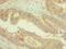 Paired Box 4 antibody, LS-C376275, Lifespan Biosciences, Immunohistochemistry paraffin image 