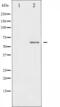 Interleukin 10 Receptor Subunit Alpha antibody, abx011852, Abbexa, Western Blot image 