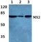 MX Dynamin Like GTPase 2 antibody, PA5-36985, Invitrogen Antibodies, Western Blot image 