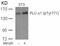 1-phosphatidylinositol-4,5-bisphosphate phosphodiesterase gamma-1 antibody, PA5-37685, Invitrogen Antibodies, Western Blot image 