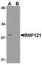 Ring Finger Protein 121 antibody, A13318, Boster Biological Technology, Western Blot image 