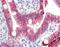 Lysosome membrane protein 2 antibody, orb96415, Biorbyt, Immunohistochemistry paraffin image 