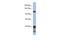 Signal-Induced Proliferation-Associated 1 antibody, A05549-1, Boster Biological Technology, Western Blot image 