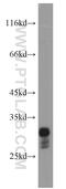 RAB26, Member RAS Oncogene Family antibody, 14284-1-AP, Proteintech Group, Western Blot image 